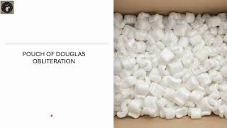 POUCH OF DOUGLAS OBLITERATION [upl. by Yarod]