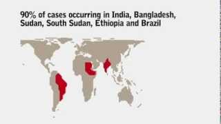 What do you know about Visceral Leishmaniasis Kala Azar [upl. by Haroved]