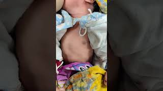 Chest Indrawing in 1day neonate repiratorydistress [upl. by Eirrehs312]