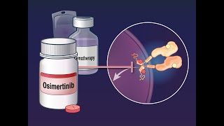 Osimertinib with Chemotherapy in EGFRMutated NSCLC  NEJM [upl. by Hellman830]