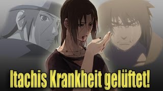 Itachis Krankheit ERKLÄRT  SerienReviewer [upl. by Assitruc216]