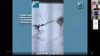 Webinar Trombo Embolismo Pulmonar Terapia Endovascular [upl. by Dun345]