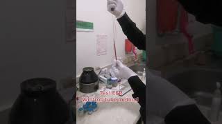 ESR test  Wintrob tube method erythrocyte sedimentation rate  shorts youtubeshorts bloodtest [upl. by Fontes]