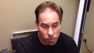 Joses Bosley Hair Transplant Review  2 weeks PostProcedure [upl. by Lelia]