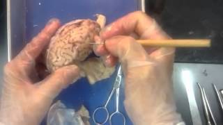 Prof Wilson sheep brain dissection edited for YouTube leng [upl. by Fulvia]