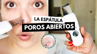 Pruebo la ESPÁTULA ULTRASÓNICA contra POROS ABIERTOS y sebo facial  Pretty and Olé [upl. by Melvena]