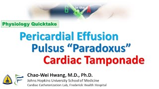 Pulsus Paradoxus Pericardial Effusion Cardiac Tamponade [upl. by Harlow]