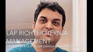 Lap Richter Hernia Management  Dr Manish K Gupta [upl. by Eardnaed337]