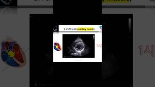 PASX papillary muscle level check point echocardiography 심장초음파 papillary muscle [upl. by Harriman]