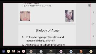 Lec 6 Treatment of Acne VulgarisPart 1 [upl. by Yevre]