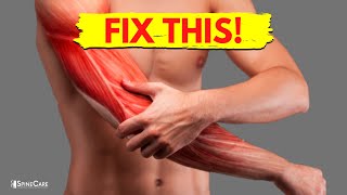 How to Fix Arm Muscle Pain in 30 SECONDS [upl. by Piper]