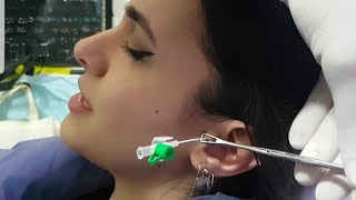 Taşlı Tragus Piercing Delimi [upl. by Odlabso]