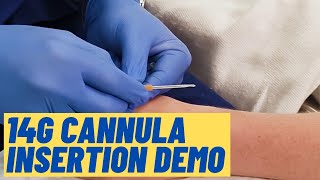 Large 14G cannula insertion technique  Live Demo [upl. by Hakilam]