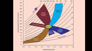 Part 2 Acidosis and Alkalosis Metabolic or Respiratorymp4 [upl. by Anialad]