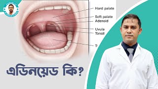 এডিনয়েড হলে কি কি সমস্যা হয় What are Adenoids Tonsils and Adenoids Operation [upl. by Allenod814]