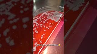 Klebsiella Hipermucoide  bacteria ciencia microbiology science lab fun divertido [upl. by Aznerol386]