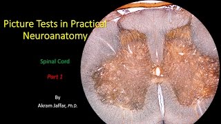 Picture Test in Neuroanatomy  Spinal Cord 1 [upl. by Senilec]