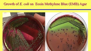 محاضرة الإيشيريشيا كولاي Escherichia coli Lecture [upl. by Ahsyekat]