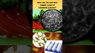 Which Are the 4 Most Common Causes of Foodborne Illnesses [upl. by Alessig]