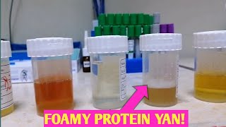 ETO PATUNAY PAG FOAMY ANG IHI MAY PROTEIN YAN [upl. by Yrnehnhoj]