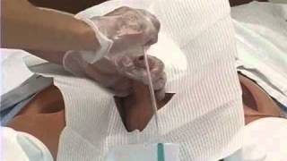 Foley Catheter Skills Demonstration 2 of 3 [upl. by Norraj]