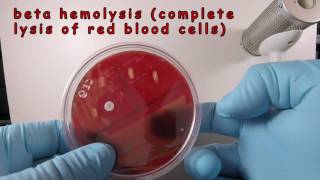 Streptococcus pyogenes on Blood Agar with a Taxo A Disc [upl. by Ssew]