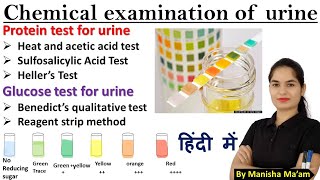 Urine Examination Part2 Chemical examination of urine  Urinalysis in hindi  Examination of urine [upl. by Vokay637]