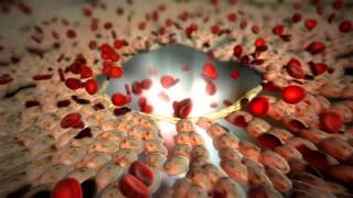 Medical Animation  Hepatic [upl. by Ecnav752]