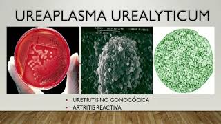 Ureaplasma Enfermedades Transmisibles [upl. by Yerdua]