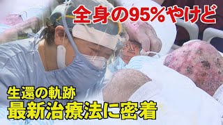 「さすってもさすっても冷たくて…」幼い女児の心臓蝕むコロナ “小児ICU” 最重症の子どもたち救う命の現場に密着【news23】｜TBS NEWS DIG [upl. by Elsey]