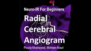 Radial Cerebral Angiogram A Video Tutorial [upl. by Ferneau23]