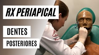 Como radiografar dentes posteriores com posicionador  Técnica periapical [upl. by Standing]