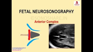 Fetal Neurosonography – Anterior Complex [upl. by Enirak]