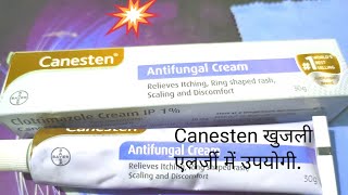 Canesten Antifungal Cream Use खुजलीएलर्जी इन्फेक्शन सफेद पानी में उपयोगी। [upl. by Jahdiel573]