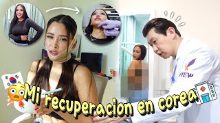 MI DOC COREANO VE MI CUERPO POR PRIMERA VEZ 👨🏻‍⚕️🏥 Así es un post operatorio en corea  Mila [upl. by Florella]