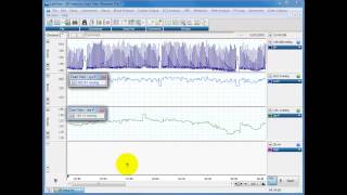 Calculating systolic diastolic and MAP from blood pressure traces [upl. by Yard899]