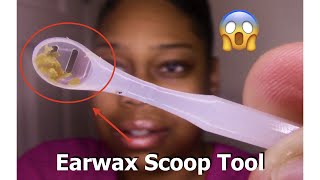 ASMR Scooping HARD Earwax Satisfying [upl. by Holmann127]