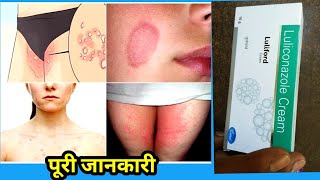 LULIFORD CREAM USES IN HINDI LULICONAZOLE CREAM USES SIDE EFFECTS IN HINDI [upl. by Nojram]