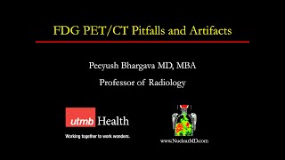 FDG PETCT Pitfalls and Artifacts [upl. by Heringer]