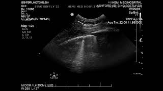 Échographie d’un poulain présentant des fractures de côtes adjacentes au cœur [upl. by Aicital]