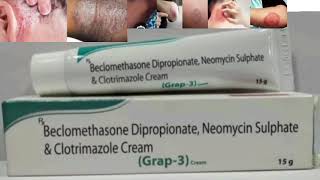 Grap 3 Cream Beclomethasone Dipropionate Neomycin Sulphate amp Clotrimazole Cream [upl. by Akeinahs]