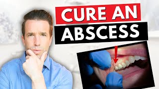 Dentist Explains a Tooth Abscess  How to Cure an Abscess Tooth [upl. by Eesac160]