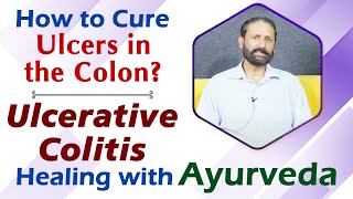 How to Cure Ulcers in the Colon  Ulcerative Colitis Healing with Ayurveda [upl. by Apollo]