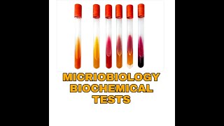 Biochemical Tests for Bacterial IdentificationTSIUrease Citratemicrobiology Biochemical tests [upl. by Ennairb870]