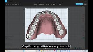 Maestro 3D  Dental Studio  User Video Tutorials  How to customize archform [upl. by Eillime557]