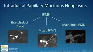 Approach to Cystic Lesions of the Pancreas [upl. by Anih438]