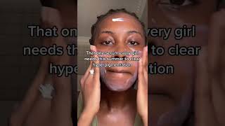 How to fade hyperpigmentation FAST [upl. by Kerek824]