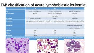 Precursor Lymphoid Neoplasms [upl. by Aniara38]