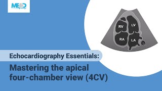 Echocardiography Essentials Mastering the apical fourchamber view 4CV [upl. by Renrag]