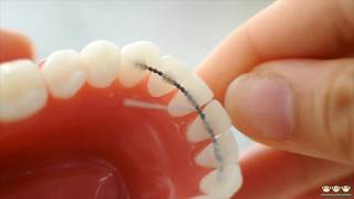 how to FLOSS your teeth WITH BRACES [upl. by Maretz]